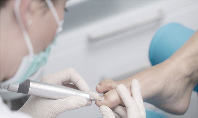 Medizinische Fußpflege bei eingewachsenem Fußnägel